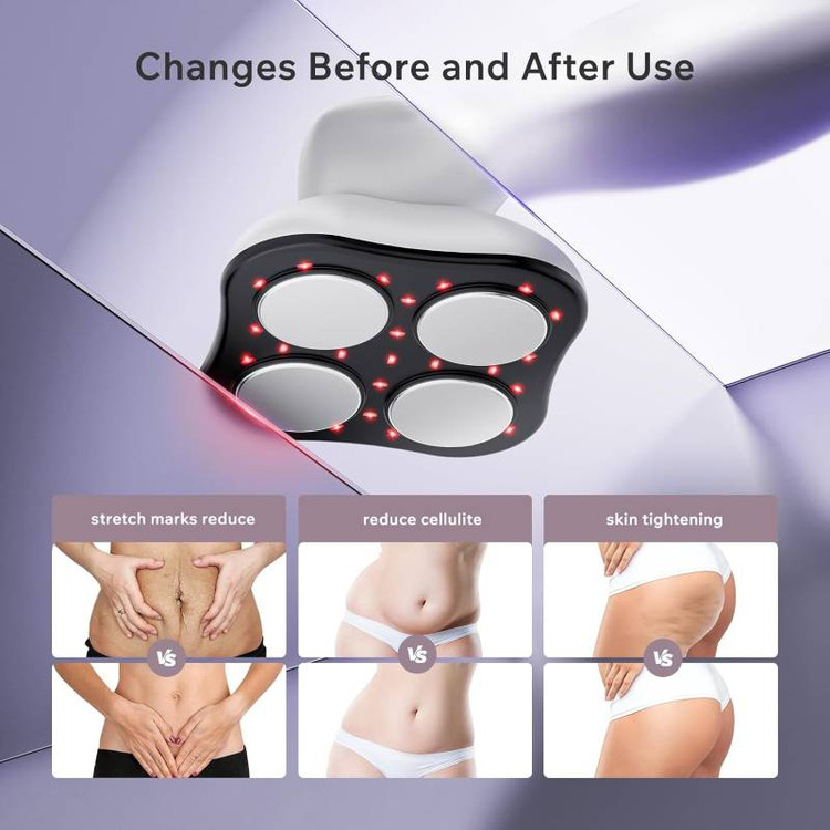 ماساژور پیکرتراشی حرفه ای سلولیت مدل F5