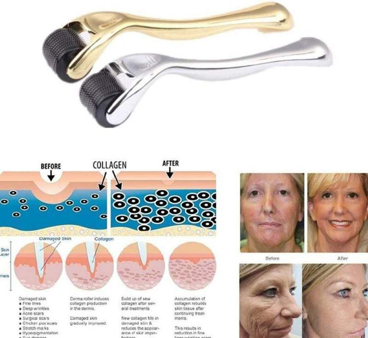 درما رولر NEEDLES 540 ماساژ زیبایی صورت تیتانیومی ۵۴۰ میکرو سوزن