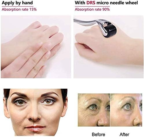 درما رولر NEEDLES 540 ماساژ زیبایی صورت تیتانیومی ۵۴۰ میکرو سوزن